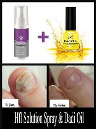 HFL Solution Spray 50 ml - KAN KUN KJØPES I KLINIKKEN